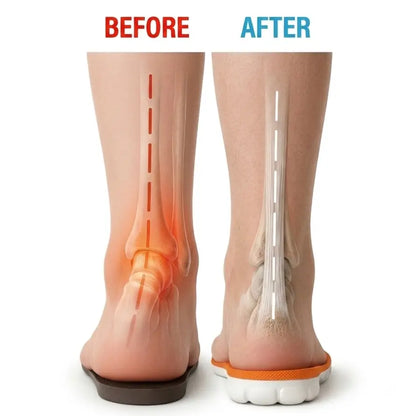 Divara Runner Cell Insoles